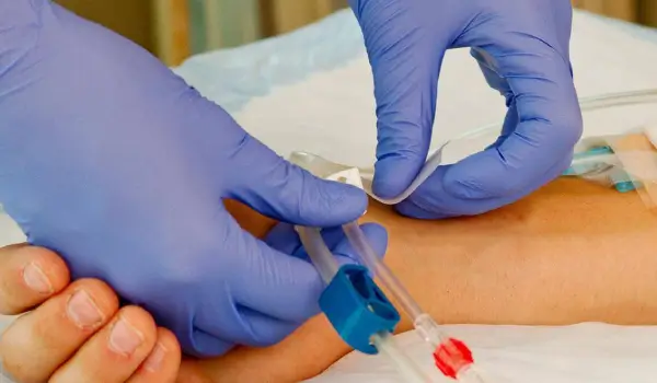 Colocación de catéter para hemodiálisis temporal y permanente en Culiacán, Sinaloa